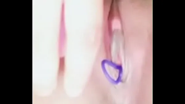 Guarda Kegel removal video caldi