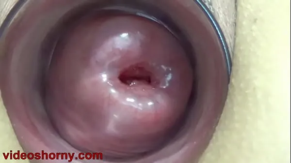 Watch Cervix Fucking pumped uterus prolapsed and t.. b. a. pussy and tormented warm Videos