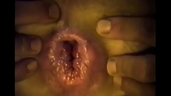 Guarda anal dilated video caldi