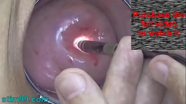 Watch Endoscope Camera inside Cervix Cam into Pussy Uterus warm Videos